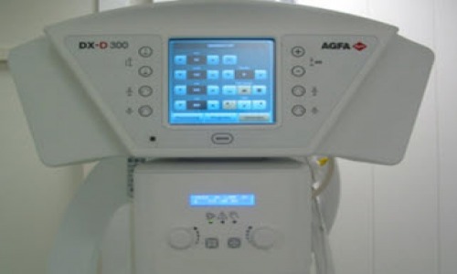 DX-D 300