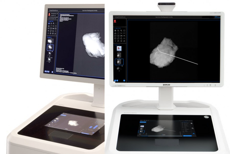 system radiografii bioptatów biopsyjnych